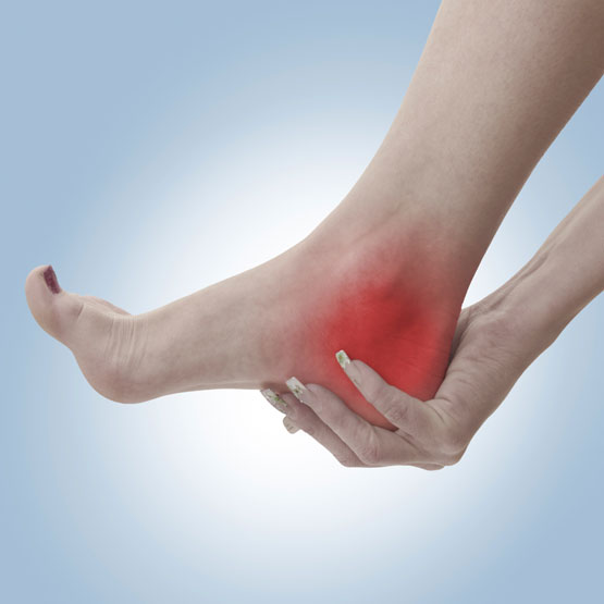 Achilles Tendonosis Bay Area Chiropractors | San Mateo Chiropractor